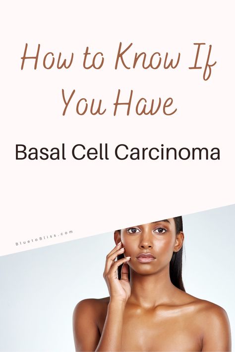 Wondering what that strange spot is on your skin? Learn how to know if you have basal cell carcinoma. #skincancerawareness #skincanceronface #skincancersigns #skincancerdiagnosis #skincancerpictures #skincancertreatment #treatmentforskincancer #basalcellcarcinoma #basalcellcarcinomapictures #basalcellcarcinomatreatment #basalcellcarcinomawarningsigns #basalcellcarcinomaremoval Basal Cell On Face, Basel Cell Carcinoma Pictures, Basil Cell Carcinoma, Basal Cell, Dermatologist Recommended Skincare, Squamous Cell, Doctor's Office, Cell Growth, Workout Chart