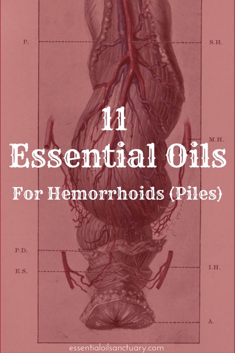 11 Essential Oils for Hemorrhoids (Piles) Plus Recipes & Application Tips Hemorrhoid Remedies, Hemorrhoid Relief, Varicose Vein Remedy, Essential Oil Remedy, Oil Remedies, Young Living Oils, Oil Uses, Essential Oil Uses, Doterra Essential Oils