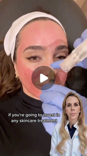 YMD Facial Plastic Surgery | PRP vs PRFM! 🥊  If you live in Orlando, Florida and you want to get this procedure done, click the link in my bio and schedule a free ... | Instagram Prp Undereye Before And After, Prp Facial, Facial Procedure, Plastic Surgery Procedures, Hydra Facial, Facial Plastic Surgery, Neck Lift, Skin Resurfacing, Facial Plastic