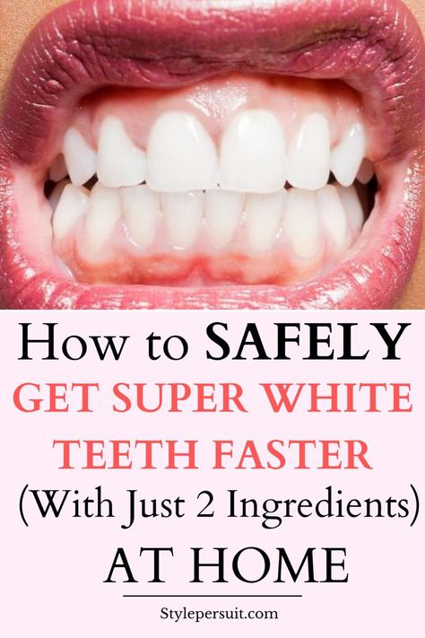 A bright, radiant smile is often considered a person's best accessory. It exudes confidence, warmth, and health. Say goodbye to teeth stains and yellow teeth. Learn how to whiten teeth wth the best teeth whiting remedies that work really overnight Try Natural Teeth Whiting at Home Remedies today Natural Tooth Whitener, Tips For Whiter Teeth, How To Whiten Teeth With Baking Soda, How To Whiten Teeth At Home Instantly, How To Clean Teeth At Home, Brushing Teeth Hacks, How To Make Your Teeth White Fast, How To Get Whiter Teeth, How To Whiten Teeth