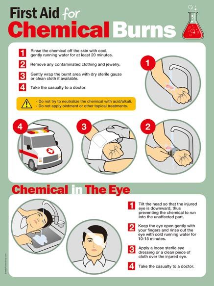 First Aid For Chemical Burns (2) | Safety Poster Shop First Aid Poster, First Aid Kit Checklist, Chemical Burn, First Aid Cpr, First Aid Tips, Safety Poster, Chemical Safety, Basic First Aid, Emergency First Aid