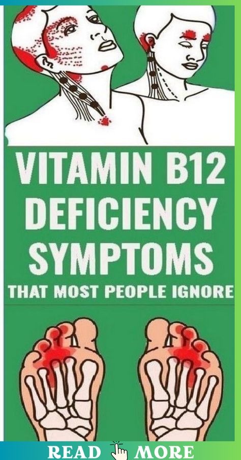 Symptoms of vitamin B12 deficiency that most people ignore B12 Deficiency Symptoms, What Is Health, Healthy Living Inspiration, B12 Deficiency, Vitamin B12 Deficiency, Healthy Facts, Slim Diet, Health Signs, Women Health Care