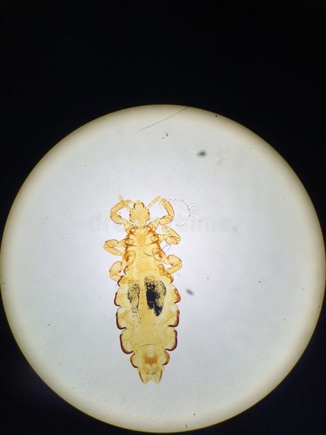 Head louse. Femal looking through the microscope #Sponsored , #sponsored, #Sponsored, #Head, #Femal, #microscope, #louse Under The Microscope, Head Louse, Business Icon, Business Icons, Business Icons Design, Design Typography, Icons Design, Typography Design, Icon Design