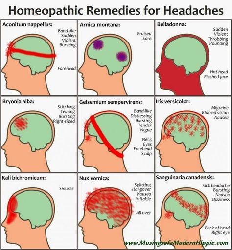 How To Stop Migraines, Remedies For Headaches, Natural Headache, For Headaches, Headache Types, Sinus Headache, Natural Headache Remedies, Migraine Relief, Headache Relief