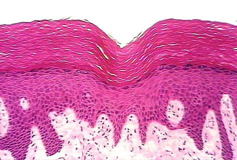 Stratified squamous keratinized epithelia is characterized by multilayered cells, providing thick protection. Keratinized provides large protection and friction resistance. This epithelia can be found in the epidermis, specifically areas that much be able to resist abrasions, such as the soles of your feet. Stratified Squamous Epithelium, Transitional Epithelium Histology, Compact Bone Histology, Stomach Histology, Connective Tissue Histology, Medical Laboratory Technician, Histology Slides, Medical Laboratory Scientist, Integumentary System