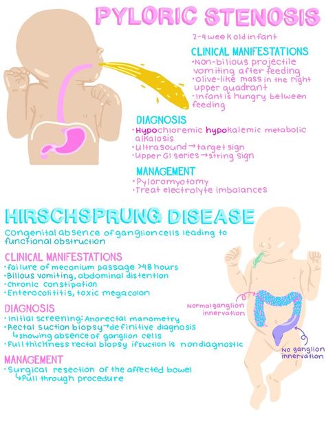 Pediatrics Nursing Notes, Peds Oncology Nursing, Pyloric Stenosis Nursing, Pediatric Nursing Notes, Pediatric Nursing Study Notes, Pediatrician Notes, Nursing Notes Pediatric, Pediatric Nursing Aesthetic, Pediatric Nursing Mnemonics