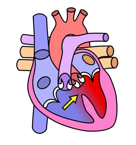 Acting as biomedical engineers, students design, build, test and redesign prototype heart valves using materials such as waterproof tape, plastic tubing, flexible plastic and foam sheets, clay, wire and pipe cleaners. They test them with flowing water, representing blood moving through the heart. As students creatively practice engineering problem solving, they demonstrate their understanding of how one-way heart valves work. Pulmonary Stenosis, Human Circulatory System, Heart Structure, Heart Diagram, Cardiac Diet, Heart Valves, Congenital Heart Defect, Low Carb Dessert, Diagram Design