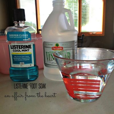 DIY Pedicure at Home - Listerine Foot Soak - Callus Remover Diy Pedicure At Home, Diy Pedicure Soak, Pedicure Soak, Best Callus Remover, Listerine Mouthwash, Listerine Foot Soak, Diy Pedicure, Pedicure At Home, Callus Remover