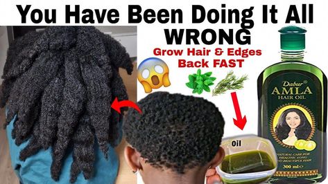 Amal Oil Hair Growth, Amla Oil For Black Hair, How To Use Amla Oil, Amla Oil For Hair Growth 4c Hair, Geritol For Hair Growth, Amla Oil For Hair Growth, Hair Fertilizer, Ayurvedic Hair Growth, Grow Thick Long Hair