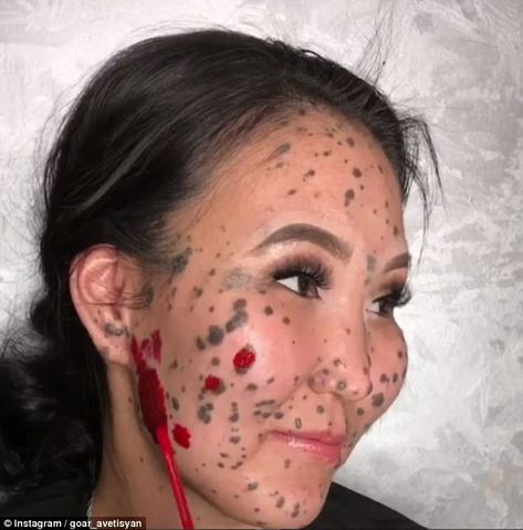 Goar applied red colour corrector on Irina's birth marks during the makeover, to even out her skin tone Beauty Marks On Face, Face Moles, Blackheads Removal Cream, Birth Marks, Moles On Face, Colour Corrector, Skin Moles, Beauty Marks, Newborn Feeding