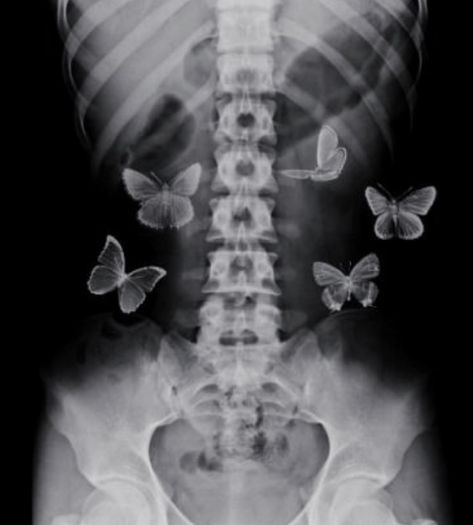 Black Butterflies Aesthetic, Skeleton Artwork, Butterfly Black And White, Collage Des Photos, Butterflies In My Stomach, Butterfly Poster, Butterfly Drawing, Black Butterfly, Black And White Aesthetic