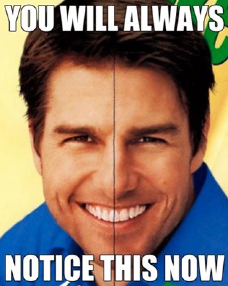 Once you've seen it, you will never look at Tom Cruise the same way again Tom Cruise Teeth, Orthodontic Humor, Dental Assistant Humor, Dental Social Media, Dental Jokes, Dental Fun, Dental Life, Nice Teeth, Dental Humor