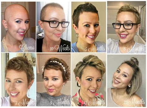 Chemo Curls, Hair Growth After Chemo, Hair Regrowth Women, Growing Out Hair, Chemo Hair, Hair Growth Secrets, Hair Regrowth Treatments, Mega Hair, Regrow Hair