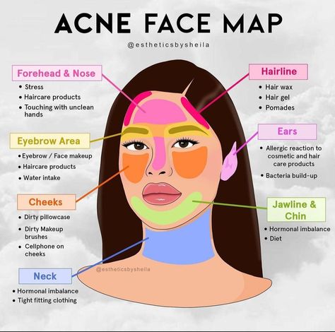 Face Map, Face Mapping Acne, Face Mapping, Skin Advice, Skin Care Routine Order, Basic Skin Care, Good Skin Tips, Basic Skin Care Routine, Perfect Skin Care Routine