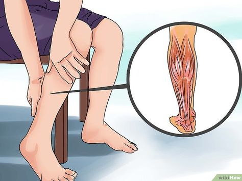 How to Treat a Torn Calf Muscle: 14 Steps (with Pictures) Torn Calf Muscle, Lower Leg Pain, Aching Knees, Soleus Muscle, Gastrocnemius Muscle, Calf Strain, Calf Injury, Knee Pain Exercises, Calf Leg