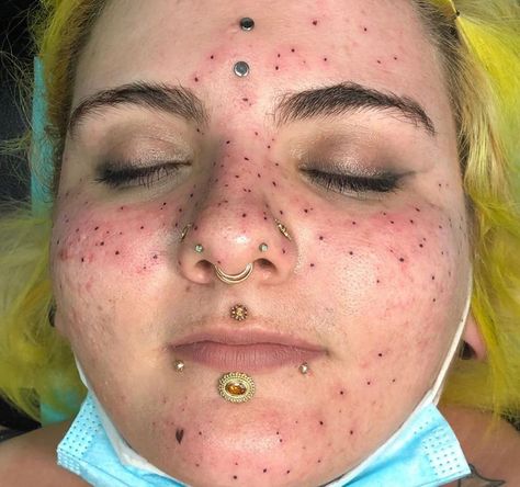 Not blackheads just tattooed "freckles" Hairstyles Back To School, Freckle Tattoo, Awful Tattoos, Tattooed Freckles, Situationship Quotes Feelings, Bendy Candles, Hair Fails, Face Tattoos For Women, Tattoo Fails