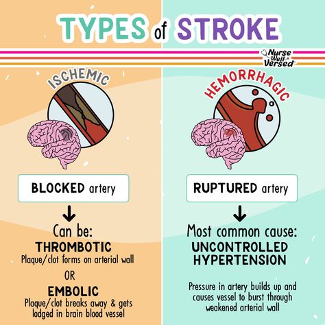 Ischemic Strokes, Different Types Of Strokes, Types Of Strokes, Emt Study, Nursing School Studying Cheat Sheets, Medical Terminology Study, Medicine Notes, Medical School Life, Nursing School Essential