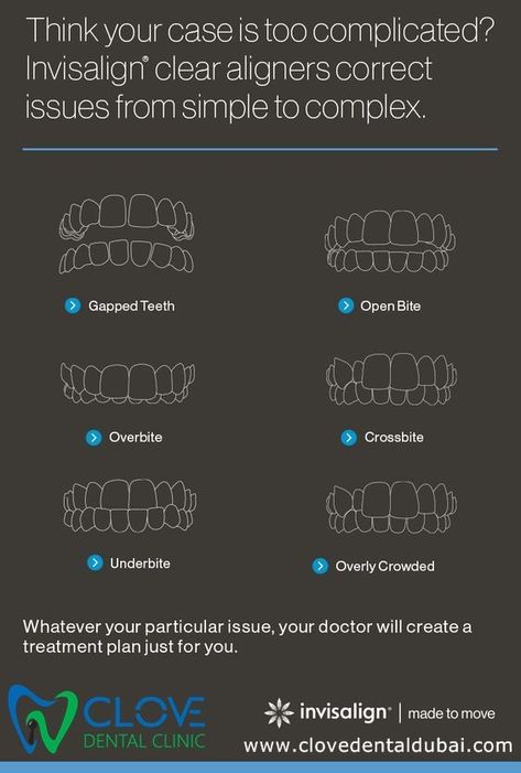 Overbiteunderbitegapped teethor crowdingInvisaligntreatment is proven to fix both simple and complex teeth straightening cases for teensTo Book your Complimentary AppointmentCall04 3435424 Whats app05 8965 6295 websitewww.clovedentaldubai.comwireless youdeservebetter changeyoursmile changeyourlife teethtronformation dubaidental SMILEUAE Overbite Before And After, Gapped Teeth, Smile Tips, Misaligned Teeth, Invisalign Aligners, Gap Teeth, Clear Aligners, Teeth Straightening, Study Organization