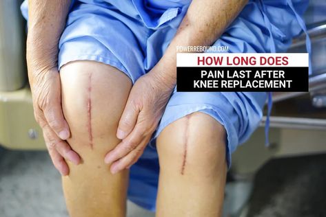 How Long Does Pain Last After Knee Replacement: What to Expect | PowerRebound™ Full Knee Replacement, Knee Replacement Pain, Knee Replacement Surgery Recovery, Stiff Knee, Knee Replacement Exercises, Knee Replacement Recovery, Knee Surgery Recovery, Swollen Knee, Knee Pain Exercises