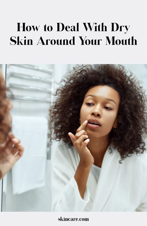 Dealing with dry skin around your mouth can be annoying and really uncomfortable. We asked a dermatologist what causes this skin-care problem and how to fix it. Dryness Around Mouth, Skin Care For Winter Dry Skin, Dry Skin Around Mouth, Dry Patches On Face, Jeera Water Recipe, Dry Skincare, Body Flush, Face Routine, Dry Skin On Face