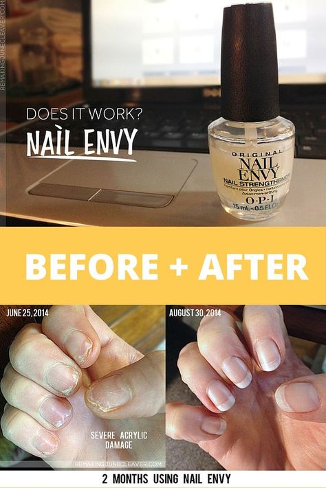 Nail Envy Opi, Nails After Acrylics, Nail Growth Tips, Opi Nail Envy, Natural Gel Nails, Weak Nails, Broken Nails, Nail Repair, Damaged Nails