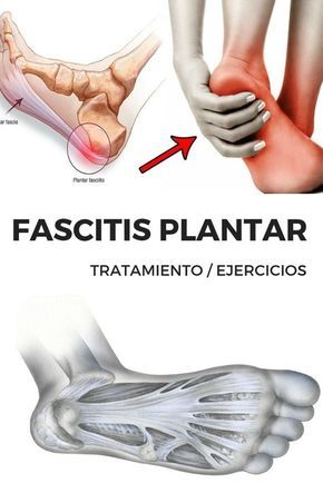 CURAR FASCITIS PLANTAR ¿Sientes DOLOR EN EL TALÓN? ¿Te dijeron que sufres FASCITIS PLANTAR? ¿Quieres descubrir los MEJORES TRUCOS para PREVENIR y CURAR esta maldita LESIÓN?En este artículo vamos a darte los mejores consejos para prevenir y curar la FASCITIS PLANTAR. Facitis Plantar, 30 Minute Workout, Massage Techniques, Reflexology, Health Conditions, Acupressure, Alternative Medicine, Massage Therapy, Health And Safety