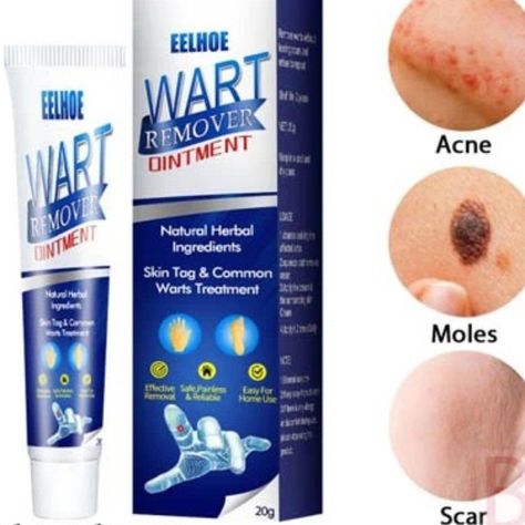 Eelhoe Other | Eelhoe 100% Natural Extract Wart Remover Ointment New In Box 20 G | Color: Blue/White | Size: 20 G Wart Cream, Aloe Vera For Sunburn, Home Remedies For Warts, Warts Remedy, Wart Remover, Natural Remedies For Migraines, Natural Acne Remedies, Dry Skin Remedies, Dark Underarms