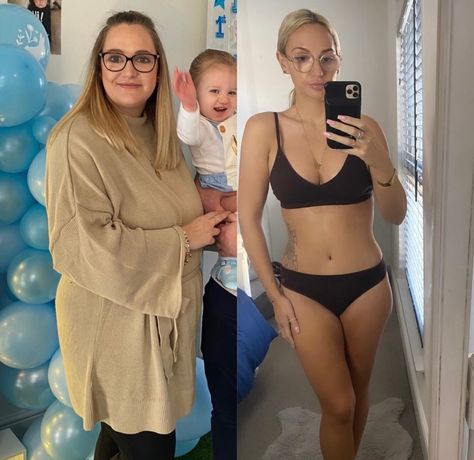 Mummy Makeover, Looking In The Mirror, Surgeon Doctor, Confident Person, Excess Skin, Put On Weight, Two Kids, Breast Lift, Tummy Tucks