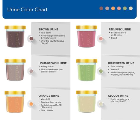 urine color chart - Google Search Urine Color Chart, Green Urine, Color Of Urine, Urine Color, Cloudy Urine, Nursing Goals, Different Foods, Medical Facts, Extreme Workouts