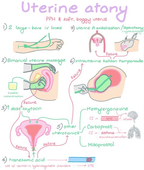 Nursing School Studying Cheat Sheets, Nursing School Inspiration, Midwifery Student, Nursing School Essential, Nursing Study Guide, Medical School Life, Medicine Studies, Nurse Study Notes, Nursing Mnemonics