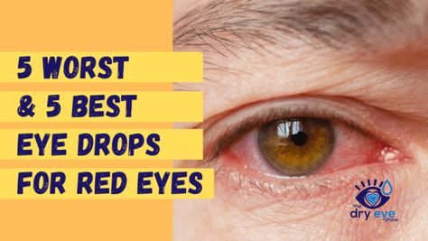 Dr. Zigler discusses why Visine and Clear Eyes are the WORST choice of eye drops to use and what other options might be better. Will Visine clear pink eye? Best Eye Drops, Lash Cleanser, Best Contact Lenses, Irritated Eye, Pink Eye, Clear Eyes, Juicy Lips, Eye Drops, Red Eye