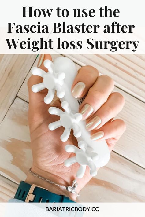 Vsg Surgery Must Haves, Biatric Surgery Before And After, Biatric Sleeve Recipes, Sadi-s Surgery, Sadi Bariatric, Bariatric Sleeve Surgery Must Haves, Sleeve Surgery Before And After, Fascia Blaster Before And After, Vsg Before And After