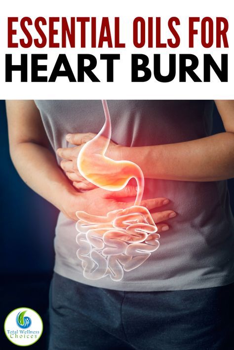 Heart Burn Relief, Preparing For Labor, Essential Oil Spray Recipes, Burn Relief, Growing Healthy Hair, Heart Burn Remedy, Pregnancy Help, Oil Remedies, Natural Pregnancy