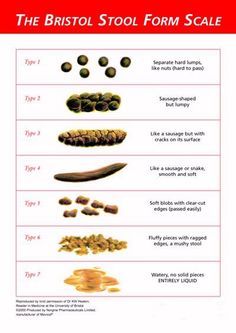 The Bristol Stool Form Scale or Bristol Stool Chart is a seven group classification of the form that appears upon defecation of human feces. Bowel Movement Chart, Bristol Stool, Bristol Stool Chart, Stool Chart, Large Bowel, Bowel Movement, Bladder Control, Irritable Bowel, Sugar Detox