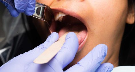 Dental Crown Procedure, Dental Anesthesia, Local Anesthesia, Family Dental Care, Dental Bridge, Dental Crowns, Dental Cleaning, Dental Procedures, Tension Headache