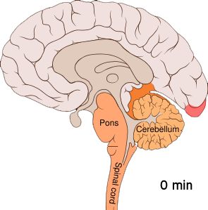 aura Migraine Aura, Human Nervous System, Spinal Muscular Atrophy, Peripheral Nervous System, Motor Neuron, Cerebral Cortex, Facial Nerve, Cranial Nerves, Brain Stem