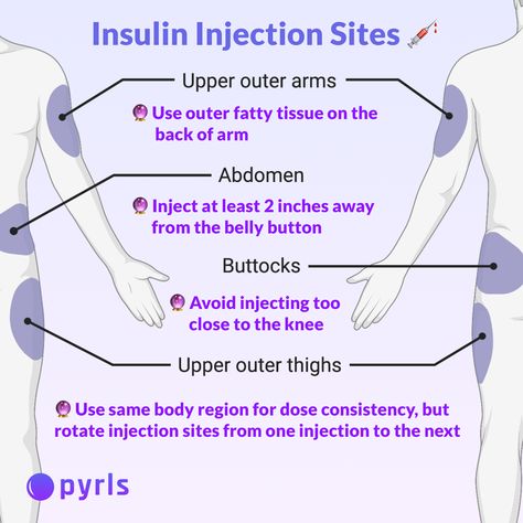 Injection Sites Nursing, Ems Notes, Insulin Injection Sites, Insulin Injection, Injection Sites, Nurse Skills, Nursing Instructor, Nurse Notes, Nurse Study