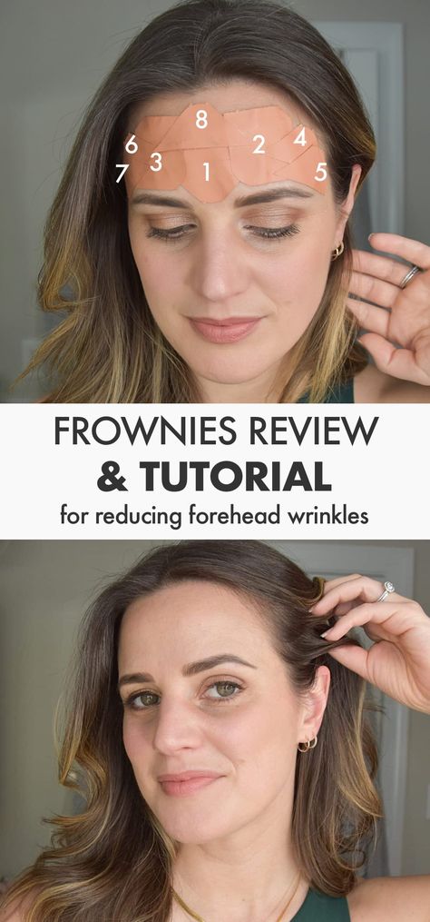 Frownies Review: My Honest Thoughts (After 1 Year) Frownies Facial Patches, Reduce Forehead Wrinkles, Skin Patches, Forehead Wrinkles, Facial Muscles, Deep Wrinkles, After Photos, Wash Your Face, Au Naturale