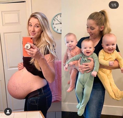 Pregnant With Triplets Belly, Triplet Pregnancy, Pregnant With Triplets, Triplets Pregnancy, Big Pregnant, Princess Diana Dresses, Pregnancy Calendar, Baby Bump Pictures, Bump Pictures