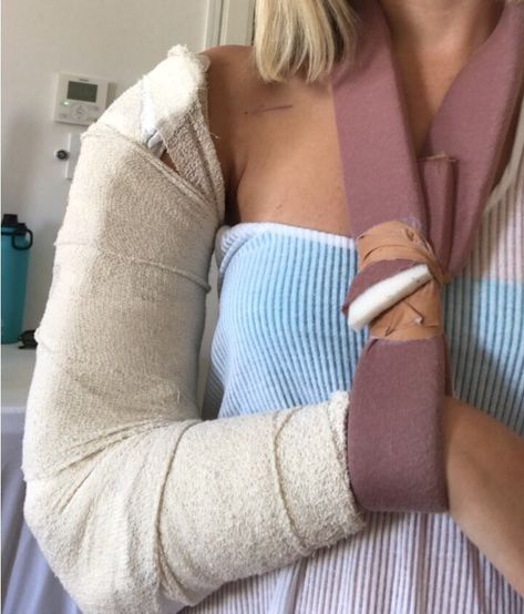 A Broken Humerus — Road to Recovery – Maddie Wirthman – Medium Broken Arm Cast Snapchat, Fractured Shoulder, Arm Excersises, Broken Arm Cast, Injury Aesthetic, Character Characteristics, Broken Elbow, Fractured Arm, Humerus Fracture