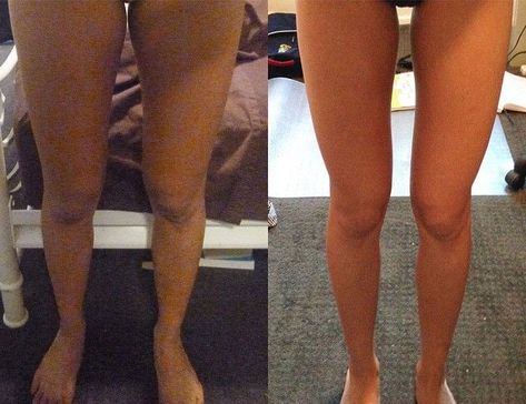 How To Get Skinny Legs: Cardio For Fat Loss and Lean Legs Rachael Attard, Thinner Legs, Cardio For Fat Loss, Tone Thighs, Lean Legs, How To Lean Out, Get Lean, Fat Loss Workout, Personal Trainers