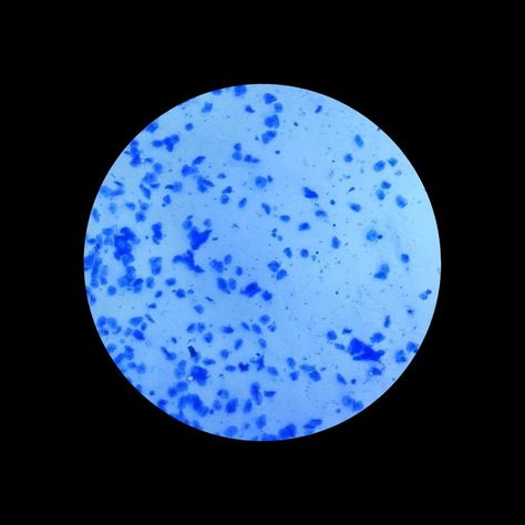 Cheek cells are composed of squamous epithelial cells. 

These structures divide every 24 hours and are constantly shed. Since they shed so easily, they are used for observation by biologists. They are stained with methylene blue for observation under the microscope as it stains the nucleus.

Stained with Methylene Blue.

Picture taken on LM-52-1706 Monocular Microscope.

#worldunderlynxmicroscope #worldunderthemicroscope #microscope #microscopes #microscopephotography #microscopeview Cheek Cells Under Microscope, Under Microscope, Methylene Blue, Background For Powerpoint Presentation, Microscopic Photography, Under The Microscope, Microscopes, Lynx, Powerpoint Presentation