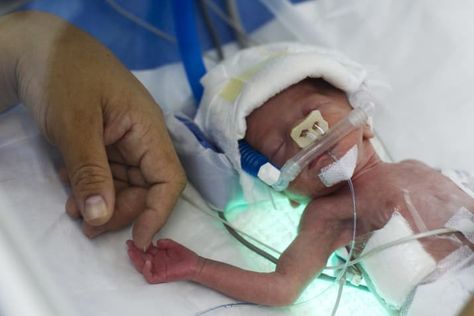 Scientists Didn’t Stop Their Study Of Premature Babies Even After Finding Out That It Depended On Broken Oxygen Meters Premature Baby, Public Records, What Is Life About, Infants, Scientists, Baby Photography, American History, About Uk, Health