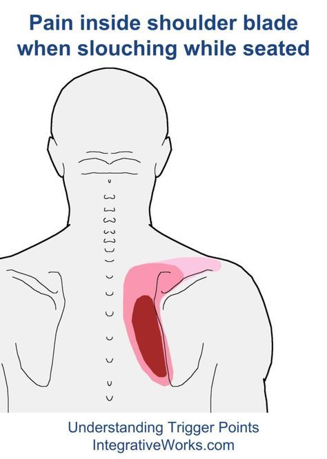 Shoulder Muscle Pain, Punkty Spustowe, Forward Head Posture Exercises, Shoulder Stretches, Forward Head Posture, Back Stretches For Pain, Shoulder Pain Relief, Trigger Point Therapy, Upper Back Pain