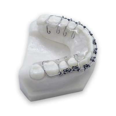 Hawley Retainer, Fake Braces, Fixed Braces, After Braces, Clear Retainers, Film Production, Braces, Theater, That Look