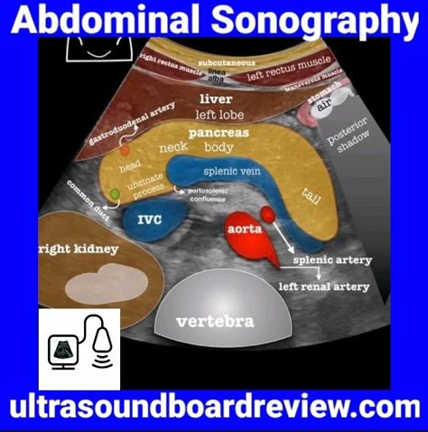 Sonography Notes, Sonography Humor, Abdominal Anatomy, Ultrasound Technician School, Abdominal Ultrasound, Diagnostic Medical Sonography Student, Ultrasound School, Ultrasound Physics, Medical Radiography