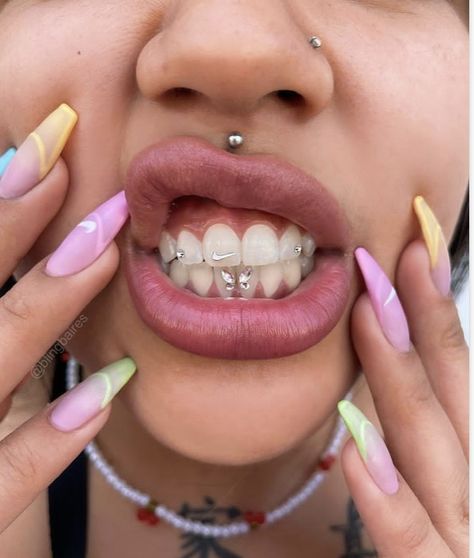 Teeth Gems, Gem Logo, Grillz Teeth, Diamond Teeth, Hip Hop Artwork, Grills Teeth, Vintage Watches Women, Tooth Gem, Gold Teeth