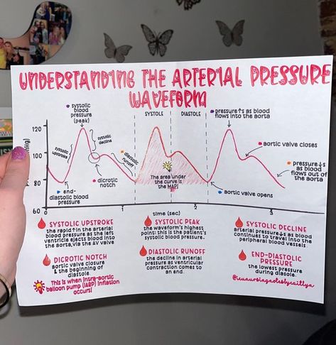 Balloon Pump Nursing, Arterial Line Nursing, Hemodynamics Nursing, Radial Artery, Arterial System, Respiratory Therapy Notes, Cardiac Cath Lab, Cath Lab Nursing, Arterial Line