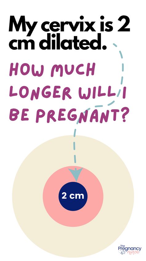 Are you feeling the first signs of labor but unsure of how long it'll take? If you're 2 cm dilated, it's time to start preparing for the big event. In this article, we'll break down what it means to be 2 cm dilated, what to expect during the next stages of labor, and how to stay informed and supported throughout your journey. How To Dilate, 2 Cm Dilated, Dilation Chart, Dilation And Effacement, Cervix Dilation, Cervical Dilation, Signs Of Labor, Contractions Labor, Delivery Nurse Gifts