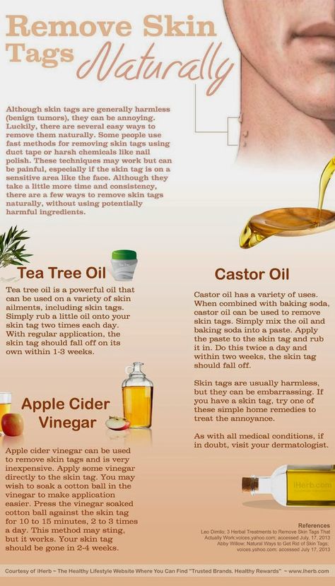 Remove Skin Tags, Apple Cider Vinegar For Skin, Remove Skin Tags Naturally, Skin Moles, Skin Tags, Cold Sores Remedies, Natural Cold Remedies, Glow Skin, Natural Cough Remedies